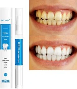 BOR Tanden Bleekpen - Tanden Bleken - Tandenbleekset - Whitening Pen - Tandenblekers - Wittere Tanden - Teeth Whitening Pen - Tanden Bleker -Mondelinge Benodigdheden Winkel 1031x1200 2