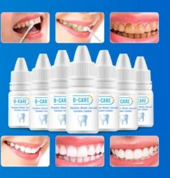 B-care Tanden Bleker – Wittere Tanden – Teeth Whitening Strips – Professioneel Resultaat - Tandsteen Verwijderaar - Zonder Peroxide - Tandenbleekset - Tanden Bleken -Mondelinge Benodigdheden Winkel 1138x1200 7