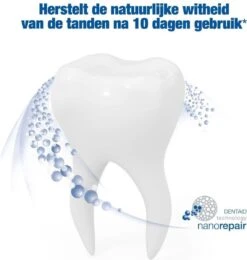 Vitis Whitening Tandpasta 4 Pack -Mondelinge Benodigdheden Winkel 1141x1200 2