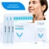 ISmile Professionele Tandenbleekset - Veilig Tanden Bleken - Zonder Peroxide - Witte Tanden - Teeth Whitening -Mondelinge Benodigdheden Winkel 1152x1200 1