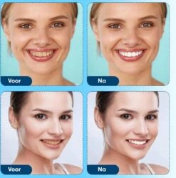 Diamond White - Teeth Whitening Strips - 28x Strips - Zonder Peroxide (0%) - Tandenbleekset - Tandenbleek Strips – Mint -Mondelinge Benodigdheden Winkel 1185x1200 1