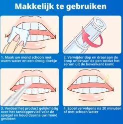 B-care Tanden Bleekpen - Teeth Whitening Pen - Tanden Bleker - Wittere Tanden - Teeth Whitening Strips - Professioneel Resultaat - Tandsteen Verwijderaar - Zonder Peroxide - Tandenbleekset - Tanden Bleken -Mondelinge Benodigdheden Winkel 1185x1200 2