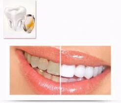 Merkloos Tanden Whitener Pen - Professionele Tandenbleek Gel - Tandenbleker -Mondelinge Benodigdheden Winkel 1200x1026 1