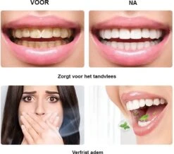 BOR Tanden Bleekpen - Tanden Bleken - Tandenbleekset - Whitening Pen - Tandenblekers - Wittere Tanden - Teeth Whitening Pen - Tanden Bleker -Mondelinge Benodigdheden Winkel 1200x1061 2