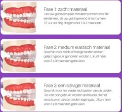 Edoir Rechte Tanden Beugel - Retainer Voor Rechte Tanden - Rechte Tanden Bitje -Mondelinge Benodigdheden Winkel 1200x1109 1