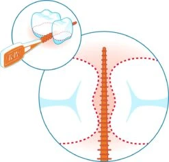 Tepe EasyPick Paars Maat XL – 36 Stuks 18 Tepe EasyPick Paars Maat XL – 36 Stuks -Mondelinge Benodigdheden Winkel 1200x1146 2