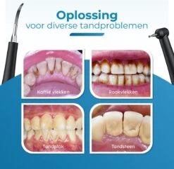 Professionele Tandsteen Verwijderaar - 5 Standen - Inclusief Tandarts Set - Met 3 Opzetstukken - Elektrisch - Tandplak -Mondelinge Benodigdheden Winkel 1200x1169 4