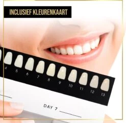 The Million Dollar Smile® Tandenbleekset Geschikt Voor Gevoelige Tanden - Zonder Peroxide (0%) - Wittere Tanden - 100% Natuurlijk - Tanden Bleken - Tandenblekers - Teeth Whitening Kit - Geen Gevoelige Tanden -Mondelinge Benodigdheden Winkel 1200x1169 5