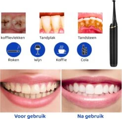 ExCorn Elektrische Tandsteen Verwijderaar - Inclusief 6-delig Tandartsset - 3 Standen - Elektrisch Tandplak Verwijderen - Tanden Polijsten -Mondelinge Benodigdheden Winkel 1200x1173 2