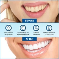 V-Goods Premium Whitening Strips - Tandenbleek Strips - Wittere Tanden - 28x Tandenbleek Strips DIRECT Resultaat - Tandenbleekset - Whitening - Tandenblekers -Mondelinge Benodigdheden Winkel 1200x1199 14