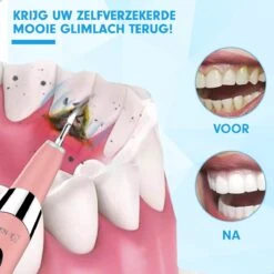 DEN-T® PRO U500 - Elektrische Sonische Tandsteen Verwijderaar - Roze -Mondelinge Benodigdheden Winkel 1200x1200 1042