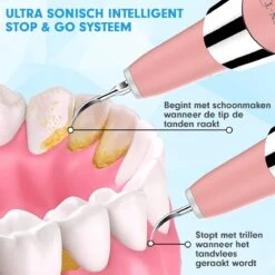 DEN-T® PRO U500 - Elektrische Sonische Tandsteen Verwijderaar - Roze -Mondelinge Benodigdheden Winkel 1200x1200 1044