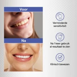 Merkloos Tanden Bleken Met 14 Sets Whitening Strips - Tandenbleekset Met Bamboe Tandenborstel - Tanden Bleekstrips -Mondelinge Benodigdheden Winkel 1200x1200 1068