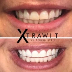Xtrawit - Teeth Whitening Strips - Tandenbleekset - Wittere Tanden - Goedgekeurde Tandenbleek Strips - 30 Strips 12 Xtrawit - Teeth Whitening Strips - Tandenbleekset - Wittere Tanden - Goedgekeurde Tandenbleek Strips - 30 Strips -Mondelinge Benodigdheden Winkel 1200x1200 1078
