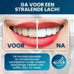 Tandenbleekset - Teeth Whitening - Teeth Whitener - Wittere Tanden - Tanden Bleken - Direct Resultaat - Zelfde Effect Als Whitening Strips -Mondelinge Benodigdheden Winkel 1200x1200 1088