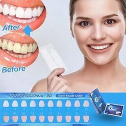 Merkloos Professionele Tanden Bleek Strips Ultra 3D - Teeth Whitening Strips - Tanden Bleken - Voor Ultra Witte Tanden - 14 Strips -Mondelinge Benodigdheden Winkel 1200x1200 1124