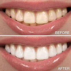 Perfect Wit - Whitening Pen - Tandenblekers - 100% Natuurlijke Ingrediënten - Peroxidevrij - Veilig Bleken - Witte Tanden - Tandbleekset - Tanden Bleken - Whitening - Teeth Whitening - Frisse Adem 16 Perfect Wit - Whitening Pen - Tandenblekers - 100% Natuurlijke Ingrediënten - Peroxidevrij - Veilig Bleken - Witte Tanden - Tandbleekset - Tanden Bleken - Whitening - Teeth Whitening - Frisse Adem -Mondelinge Benodigdheden Winkel 1200x1200 1136