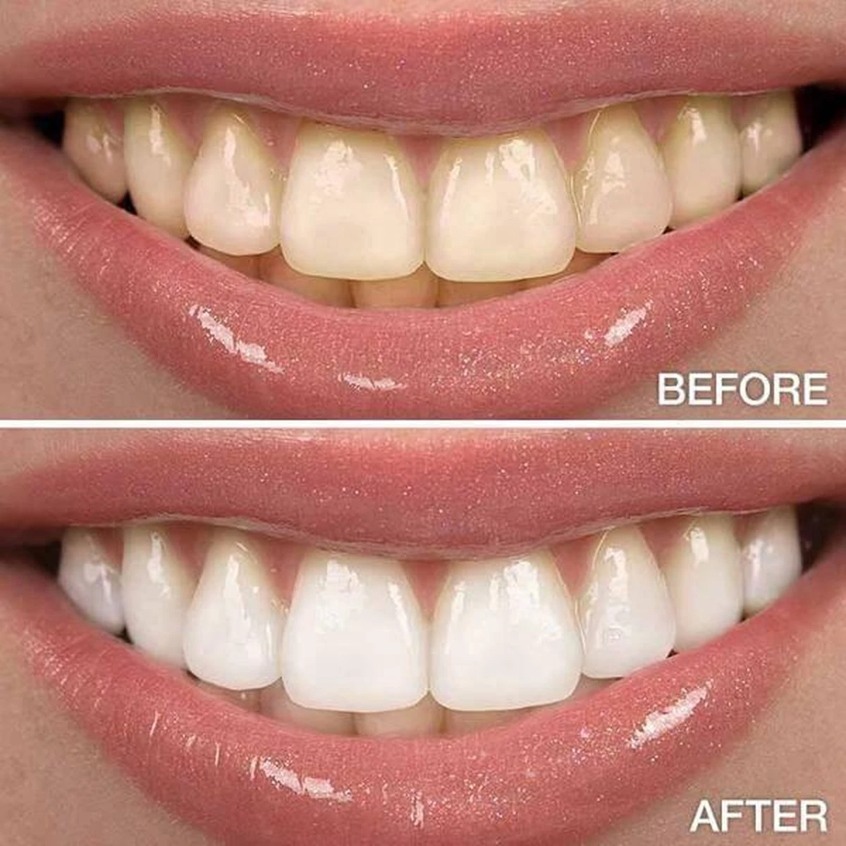 Perfect Wit - Whitening Pen - Tandenblekers - 100% Natuurlijke Ingrediënten - Peroxidevrij - Veilig Bleken - Witte Tanden - Tandbleekset - Tanden Bleken - Whitening - Teeth Whitening - Frisse Adem 9 Perfect Wit - Whitening Pen - Tandenblekers - 100% Natuurlijke Ingrediënten - Peroxidevrij - Veilig Bleken - Witte Tanden - Tandbleekset - Tanden Bleken - Whitening - Teeth Whitening - Frisse Adem - Afbeelding 7