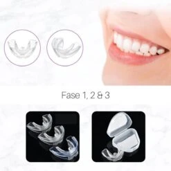Edoir Rechte Tanden Beugel - Retainer Voor Rechte Tanden - Rechte Tanden Bitje -Mondelinge Benodigdheden Winkel 1200x1200 1147