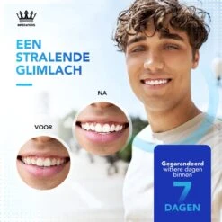 Imperatoris - Teeth Whitening Strips - 28x Strips - Zonder Peroxide (0%) - Tandenbleekset - Tanden Bleekstrips – Tanden Bleken - PAP+ -Mondelinge Benodigdheden Winkel 1200x1200 1184