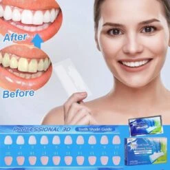 Merkloos Tanden Bleken - Witte Tanden - 5D White Teeth Whitening Strips - Teeth Whitening Strips - 28x Tandenbleek Strips - Zonder Peroxide (0%) -Mondelinge Benodigdheden Winkel 1200x1200 1201