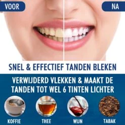 Southland Tandenbleekset - Tandenblekers - Whitening Strips - Teeth Whitening - Tanden Bleken -Mondelinge Benodigdheden Winkel 1200x1200 1202