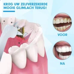 DEN-T® PRO P350 Elektrische Tandenpolijster - Wit - 5 Standen - 5 Opzetstukken - Polijstmachine - Polijstset - Tanden Polijsten - -Mondelinge Benodigdheden Winkel 1200x1200 386