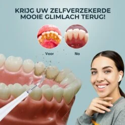 Merkloos Tandsteen Verwijderaar Elektrisch – Tandenborstel Opzetstukken - Tandarts Spiegel - 5 Standen -Wit -Mondelinge Benodigdheden Winkel 1200x1200 997