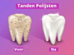 Merkloos HQ Tooth Polisher - Tanden Polijsten - Wittere Tanden - Tandsteen Tandplak Verwijderaar - Elektrisch -Mondelinge Benodigdheden Winkel 1200x886 2
