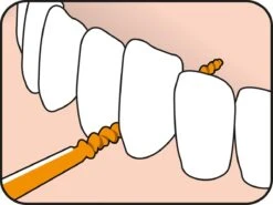 Tepe EasyPick Oranje Maat XS/S – 36 Stuks -Mondelinge Benodigdheden Winkel 1200x897 1