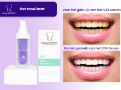 Glory Of White V34 Serum - Kleurcorrector - Witte Tanden - Tandpasta - Tanden Reinigen - Teeth Whitening - 30ML -Mondelinge Benodigdheden Winkel 1200x899 5