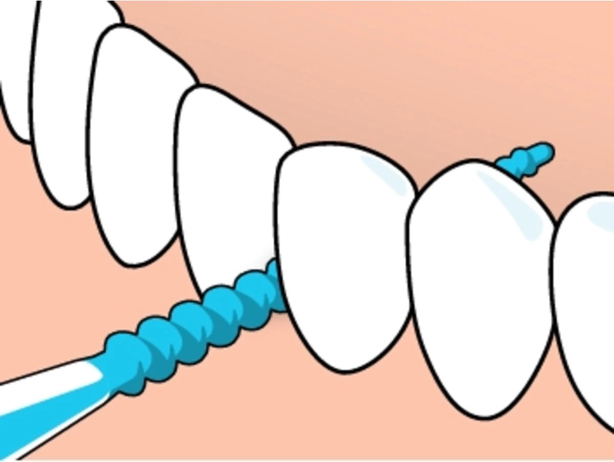 Tepe EasyPick Paars Maat XL – 36 Stuks 8 Tepe EasyPick Paars Maat XL – 36 Stuks - Afbeelding 6