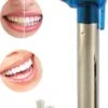 Merkloos HQ Tooth Polisher - Tanden Polijsten - Wittere Tanden - Tandsteen Tandplak Verwijderaar - Elektrisch -Mondelinge Benodigdheden Winkel 827x1200