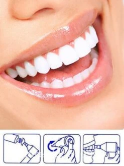 Merkloos HQ Tooth Polisher - Tanden Polijsten - Wittere Tanden - Tandsteen Tandplak Verwijderaar - Elektrisch -Mondelinge Benodigdheden Winkel 900x1200 5