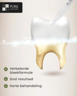 3x Navulling Tanden Bleekgel Spuiten ZONDER Peroxide - Refill Gel - Navulling - Veilig Tanden Bleken - Witte Tanden - Teeth Whitening - Valentijnsdag Cadeau -Mondelinge Benodigdheden Winkel 960x1200 17