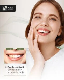 Tandenbleekset INCL. 14 Whitening Strips En 6 Gelpennen - ZONDER PEROXIDE - Teeth Whitening Kit - Tandenbleekset Met Ebook En Nederlandse Handleiding - Tandenblekers - Valentijnsdag Cadeau -Mondelinge Benodigdheden Winkel 960x1200 7